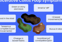 white mucus in stool