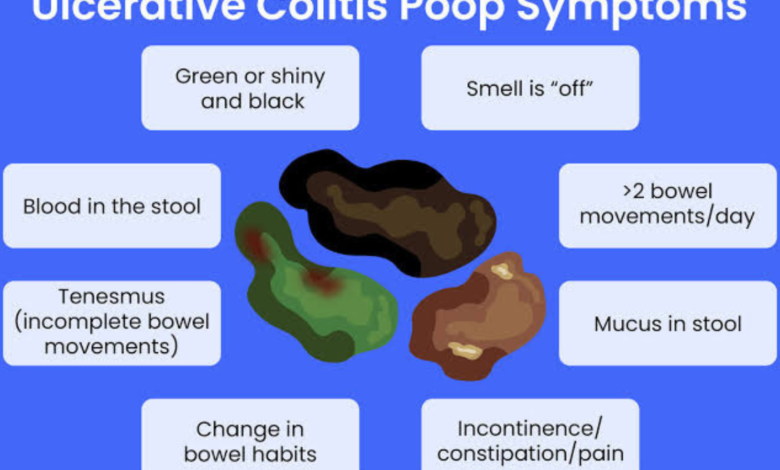white mucus in stool